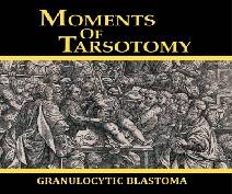 Moments of Tarsotomy
